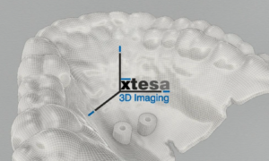 Xtesa x Dolphin Imaging